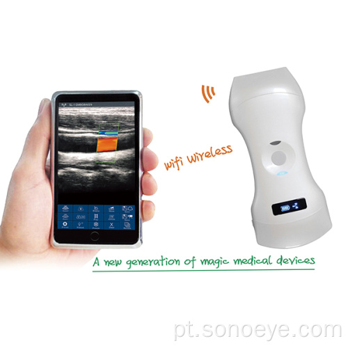 Scanner de ultra-som do hospital móvel
